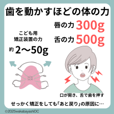 舌の力と矯正力