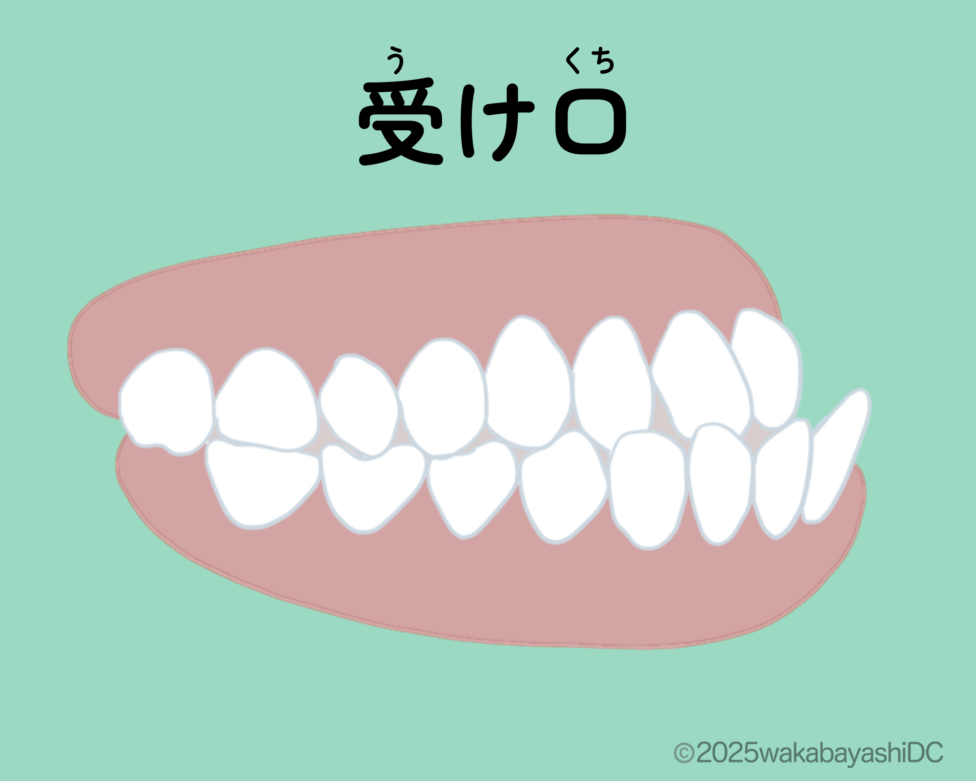 受け口