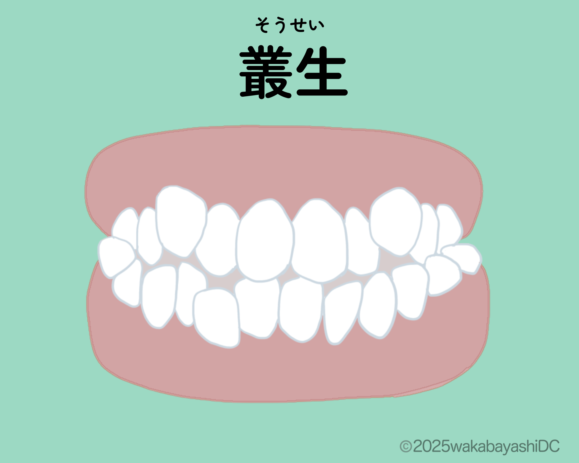 叢生