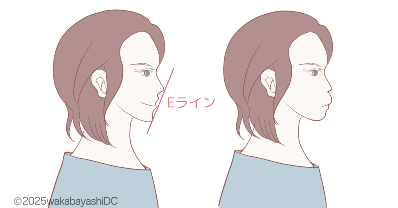口ゴボ
