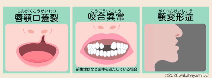 マウスピース矯正の保険適用