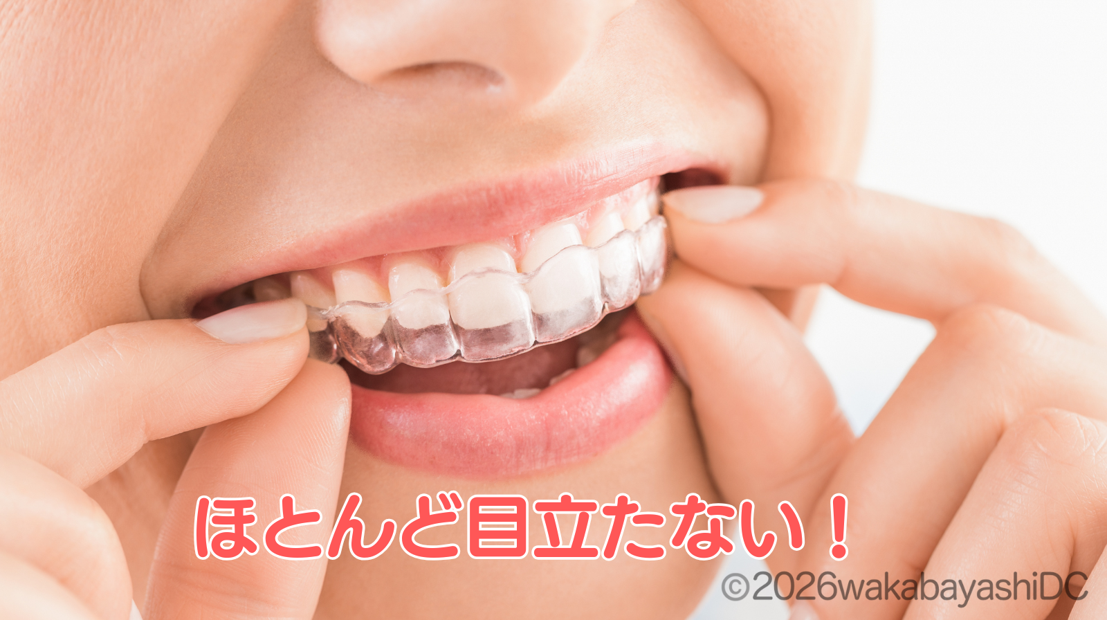 マウスピース矯正の効果