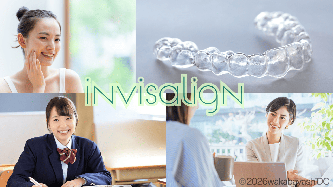 インビザライン