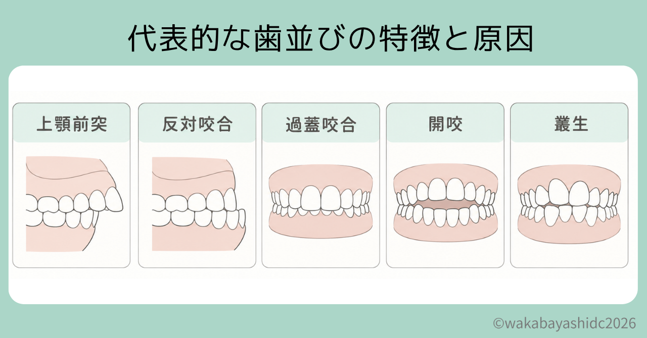 小児矯正