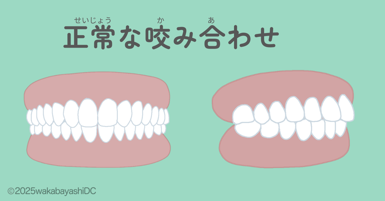 咬み合わせ