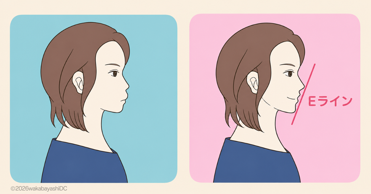 イーラインロゴボ