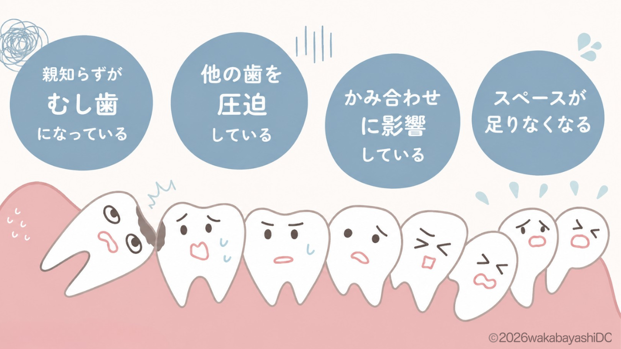 親知らず