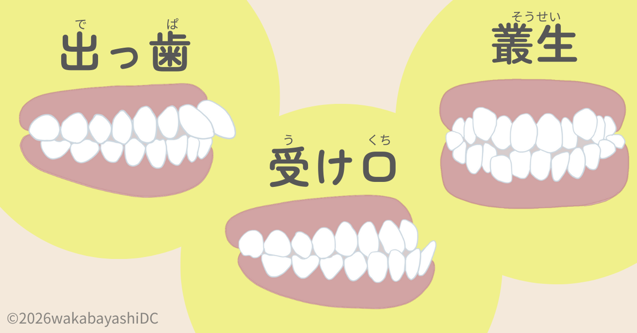 インビザライン