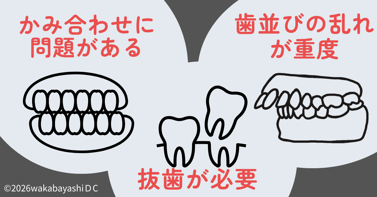 インビザライン