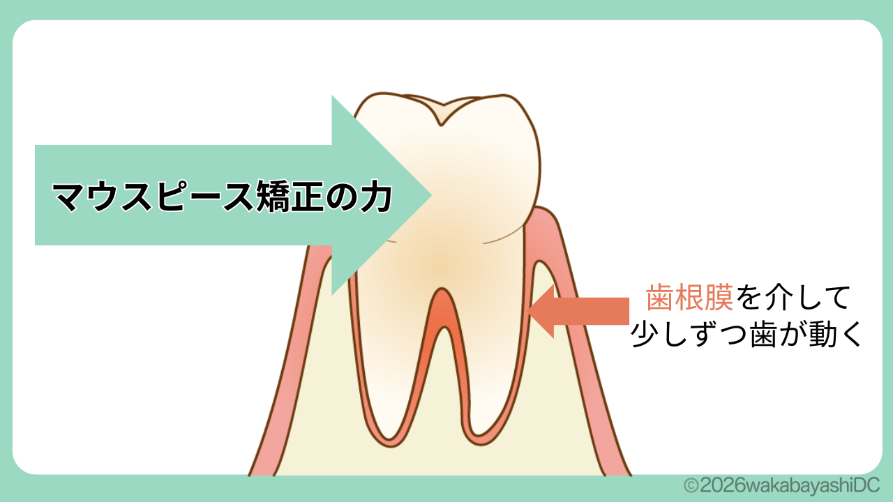 インビザライン 寝る時