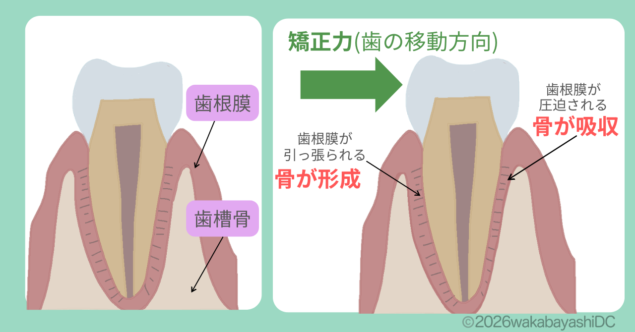 マウスピース矯正の効果