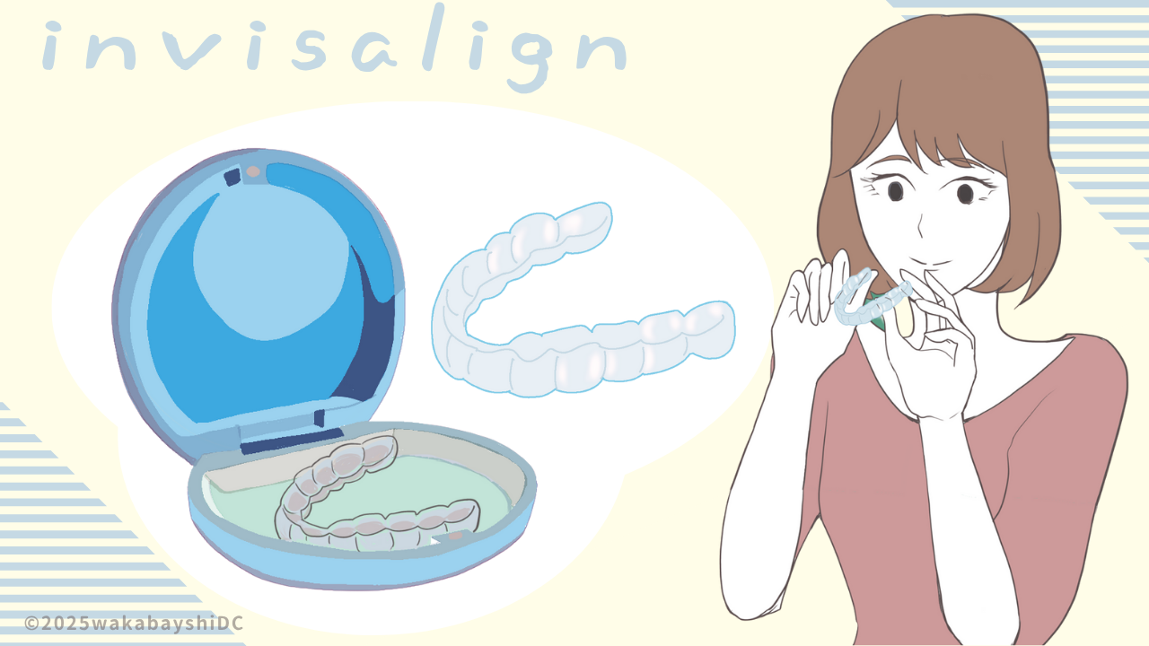 インビザラインで歯が動く仕組み
