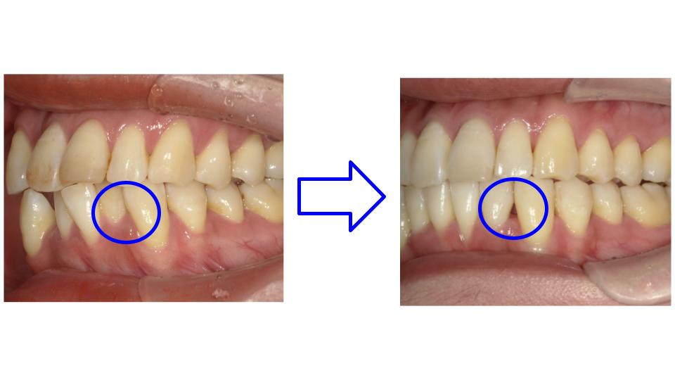 ブラックトライアングル