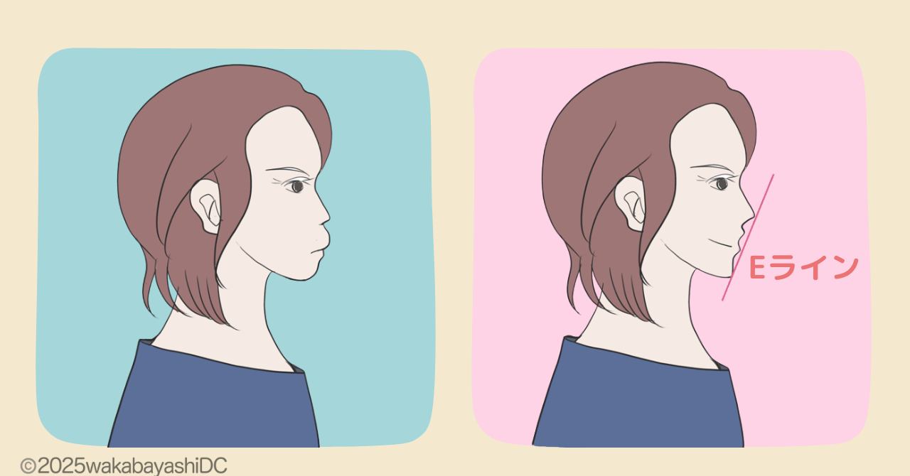 イーラインロゴボ