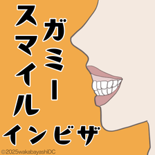 ガミースマイルはインビザラインで治療できる？期間・費用やその他の方法を紹介