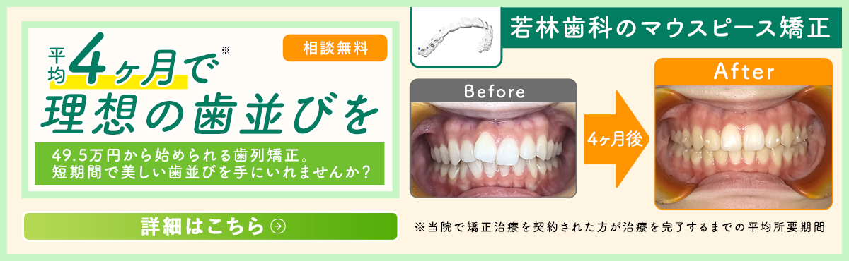平均4ヶ月で理想の歯ならびを 
