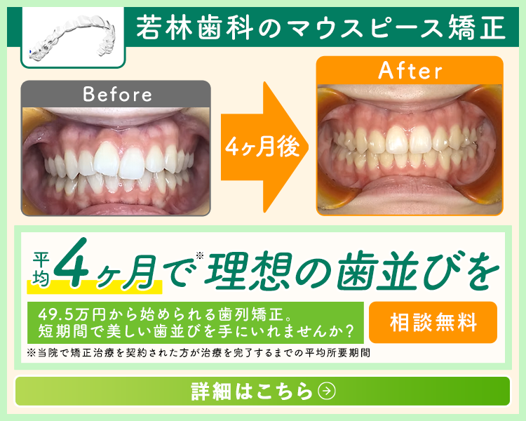 平均4ヶ月で理想の歯ならびを 